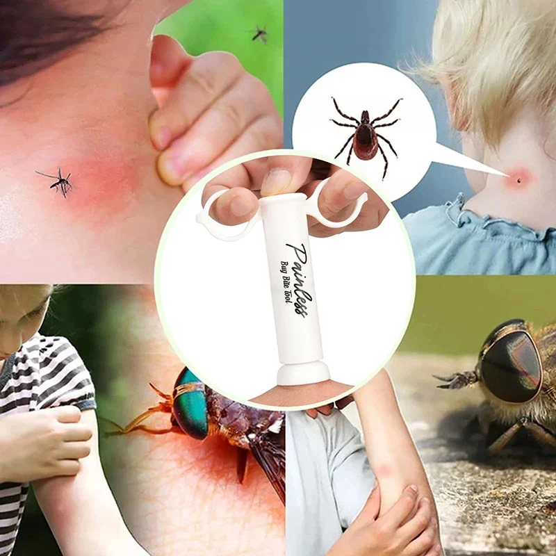 Insect Bite Suction Venom Extr - Outdoor Furniture Hay 评论和价格
