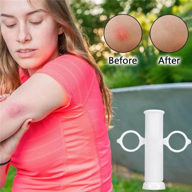 Insect Bite Suction Venom Extr - Outdoor Furniture Hay 评论和价格